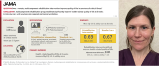 Beth Howard and a graphical abstract of the iRehab study